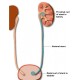 Stent Ureteral descartável de TPU