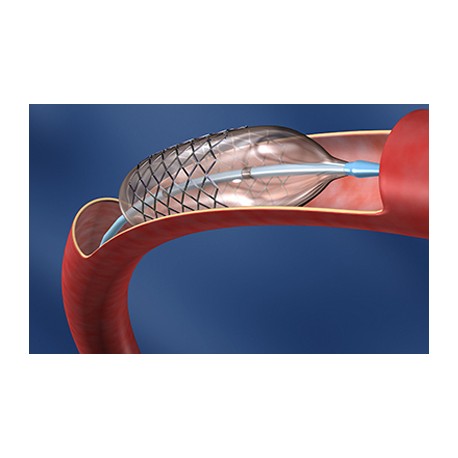 LINHA DE STENTS