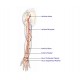 Pressão Arterial Invasiva (PAI)