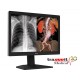 Monitor de Diagnóstico Hospitalar C630G JUSHA