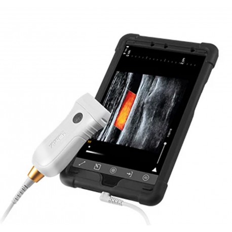 Sistema de ultrassom de bolso MX5 Go Plus