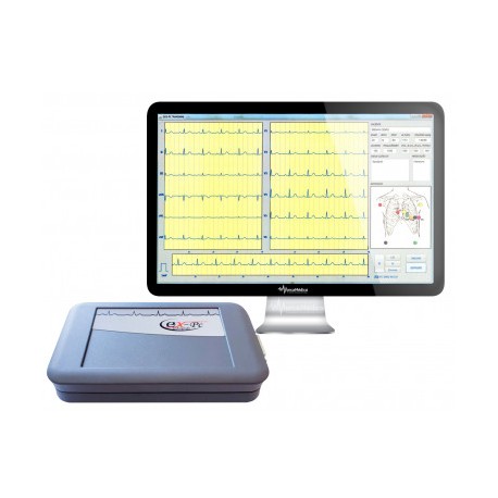 Eletrocardiógrafo ECG EX-PC USB Digital EMAI 12 derivações
