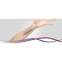 Linha arteriovenosa